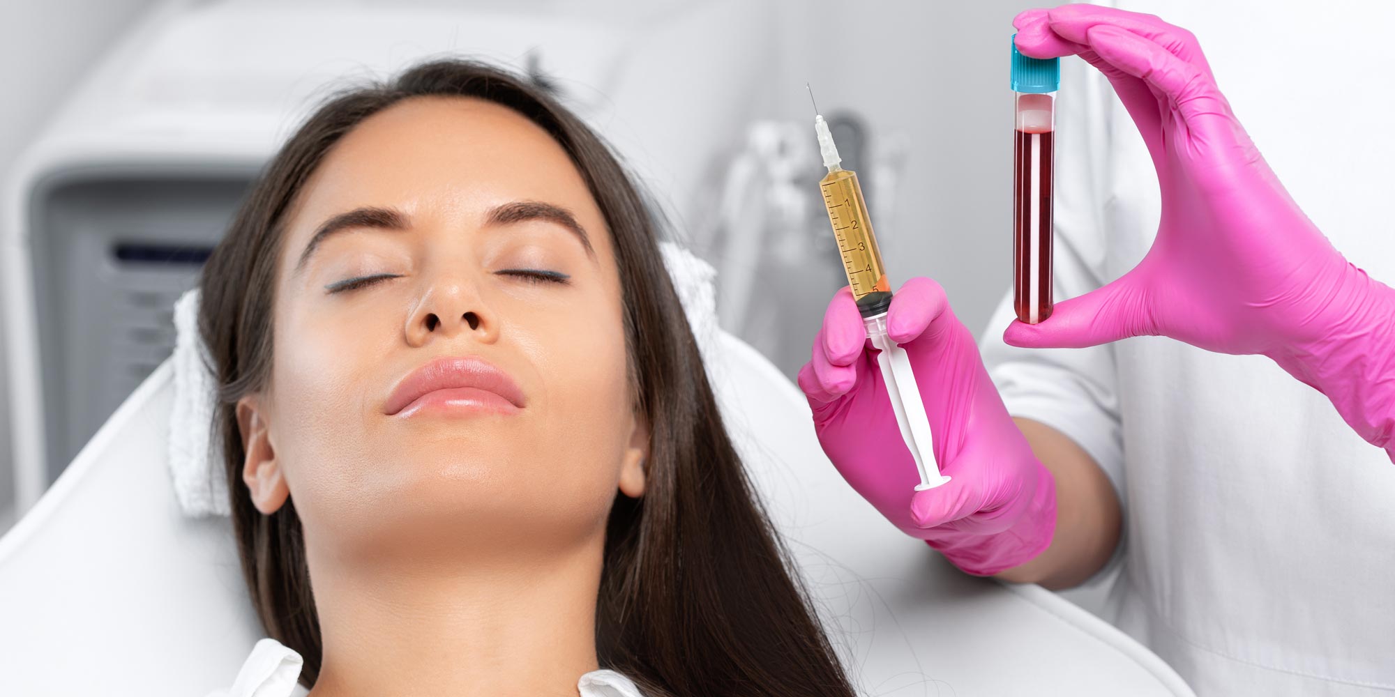 The Awesome Benefits of Platelet-Rich Plasma (PRP) Treatment